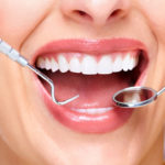 Extração do dente siso